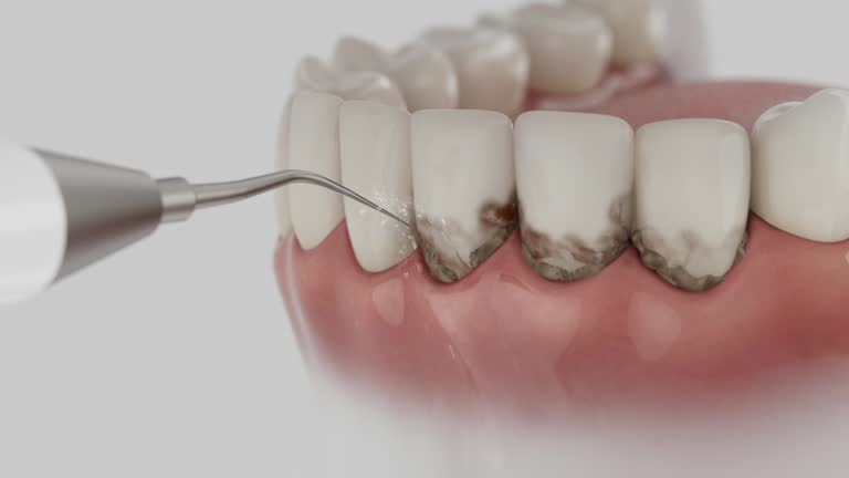 Reliable Teeth Cleaning And Checkup contractor in Banks County County, GA by Dentist Open Now